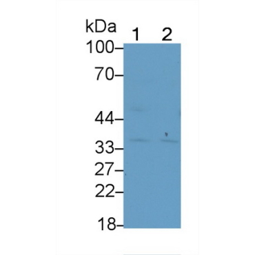 Cathepsin K (CTSK) Bovine (Cattle) Polyclonal Antibody