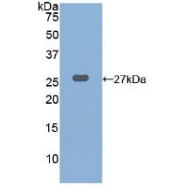 Cathepsin K (CTSK) Human Polyclonal Antibody