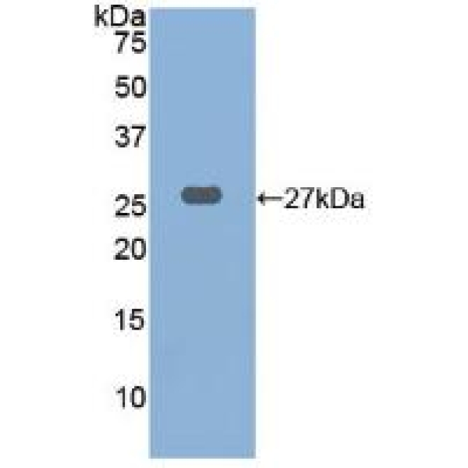 Cathepsin K (CTSK) Human Polyclonal Antibody