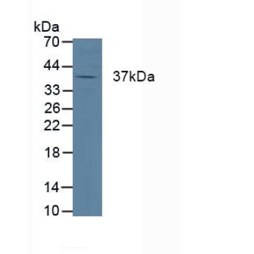 Cathepsin K (CTSK) Human Polyclonal Antibody