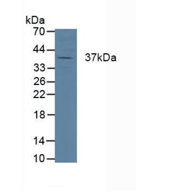Cathepsin K (CTSK) Human Polyclonal Antibody