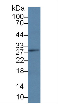 Linker For Activation Of T-Cell (LAT) Human Polyclonal Antibody