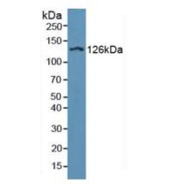 Integrin Alpha D (ITGaD) Human Polyclonal Antibody