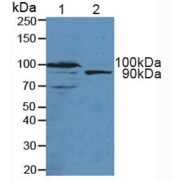 Transportin 1 (TNPO1) Human Polyclonal Antibody