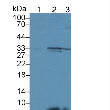 Immunoglobulin superfamily, member 1 (IGSF1) Human Polyclonal Antibody