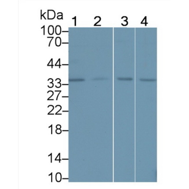 Insulin Like Growth Factor Binding Protein 6 (IGFBP6) Human Polyclonal Antibody