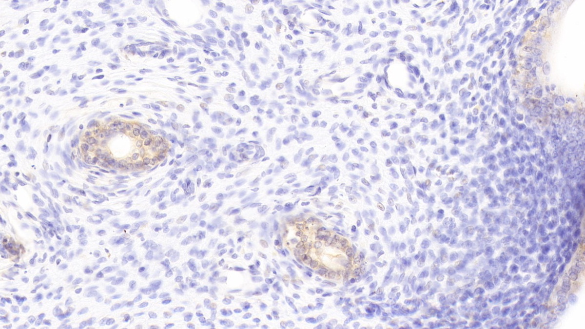 Insulin Like Growth Factor Binding Protein 6 (IGFBP6) Rat Polyclonal Antibody