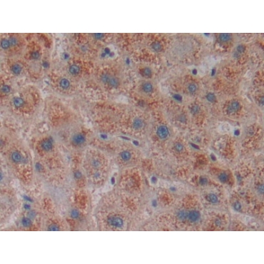 Centromere Protein E (CENPE) Human Polyclonal Antibody