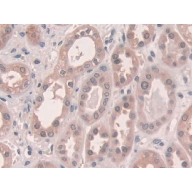 Connexin 43 (CX43) Human Polyclonal Antibody