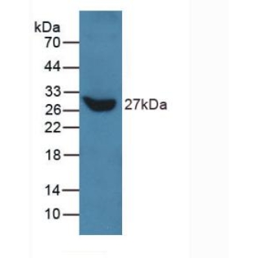 Talin 1 (TLN1) Human Polyclonal Antibody