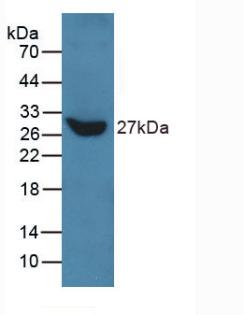 Talin 1 (TLN1) Human Polyclonal Antibody