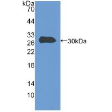 Talin 1 (TLN1) Human Polyclonal Antibody