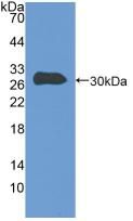 Talin 1 (TLN1) Human Polyclonal Antibody