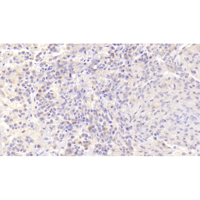B-Cell Activation Factor Receptor (BAFFR) Human Polyclonal Antibody