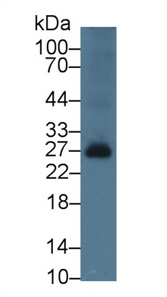B-Cell Activation Factor Receptor (BAFFR) Rat Polyclonal Antibody