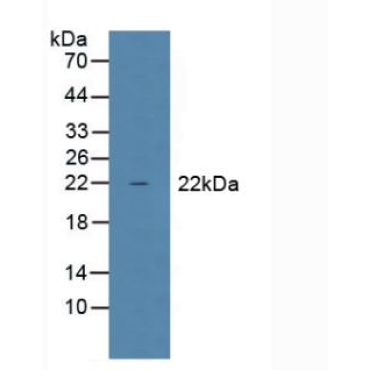 Glutathione Peroxidase 1 (GPX1) Human Polyclonal Antibody