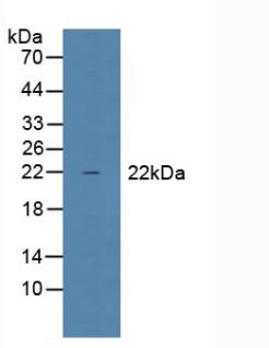 Glutathione Peroxidase 1 (GPX1) Human Polyclonal Antibody