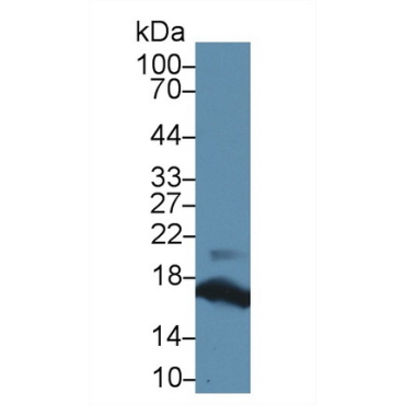 Ribonuclease A (RNase A) Human Polyclonal Antibody