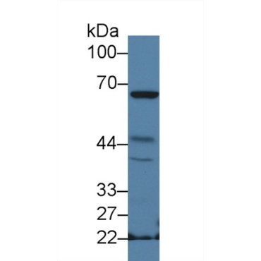 Neutrophil Cytosolic Factor 2 (NCF2) Mouse Polyclonal Antibody