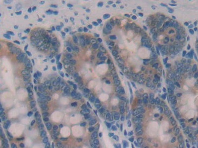 Galectin 2 (GAL2) Rat Polyclonal Antibody