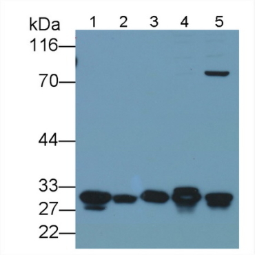 Galectin 3 (GAL3) Human Polyclonal Antibody