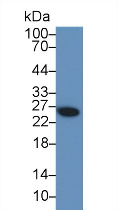 Galectin 3 (GAL3) Rabbit Polyclonal Antibody