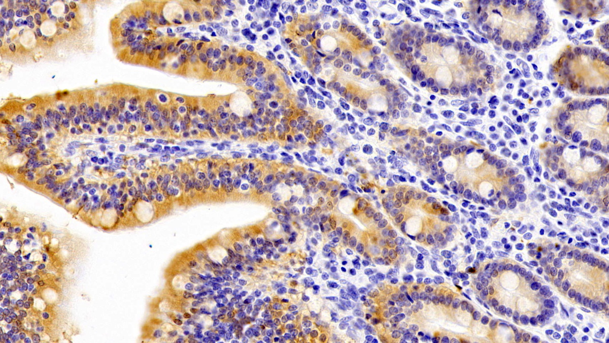 Galectin 4 (GAL4) Pig Polyclonal Antibody
