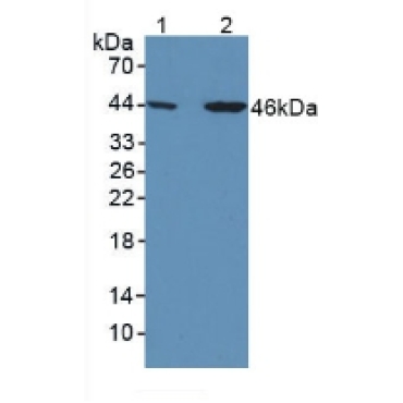 Thyroxine Binding Globulin (TBG) Human Polyclonal Antibody