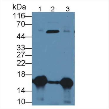 Galectin 7 (GAL7) Human Polyclonal Antibody