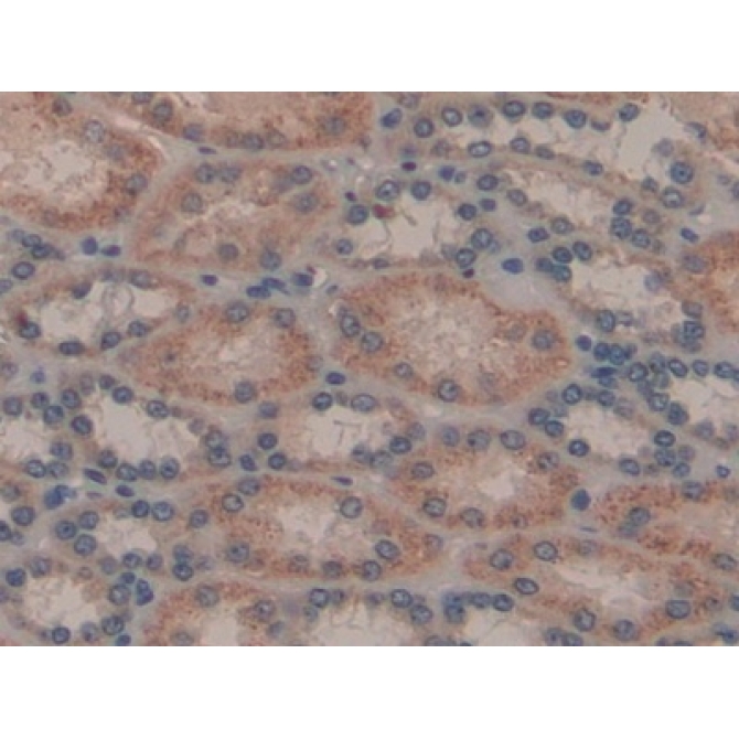 Galectin 8 (GAL8) Human Polyclonal Antibody