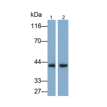 Galectin 8 (GAL8) Mouse Polyclonal Antibody