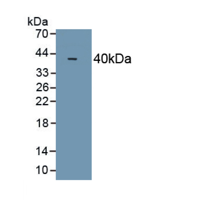 Galectin 8 (GAL8) Mouse Polyclonal Antibody