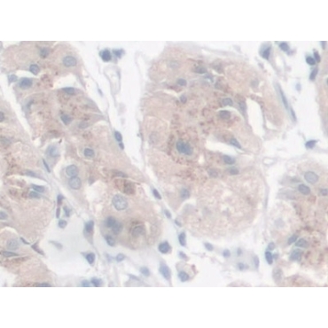 Galectin 9 (GAL9) Human Polyclonal Antibody