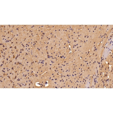 Galectin 9 (GAL9) Mouse Polyclonal Antibody