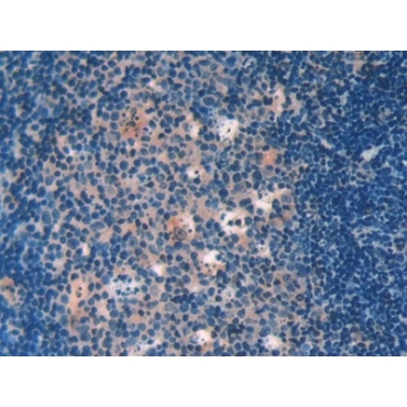 Galectin 9 (GAL9) Mouse Polyclonal Antibody