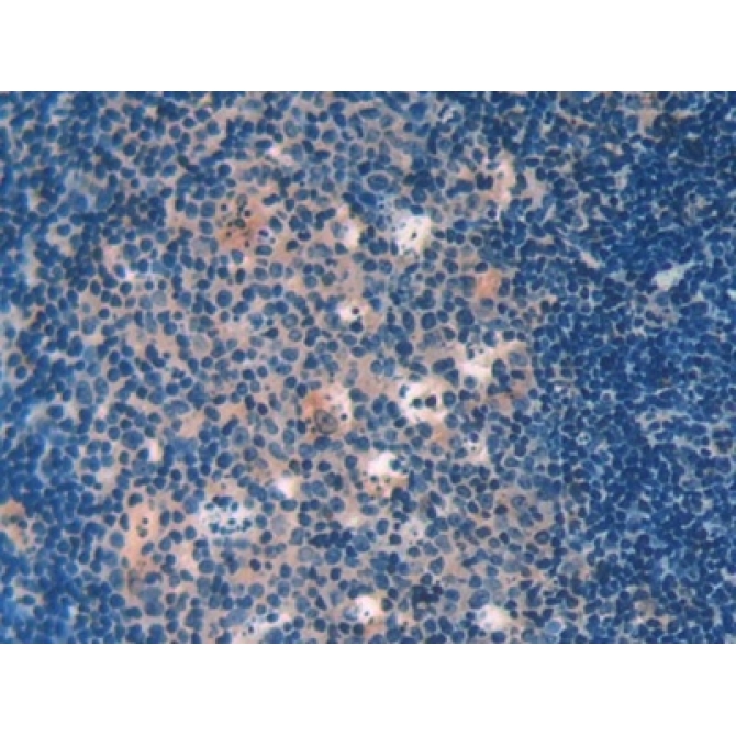 Galectin 9 (GAL9) Mouse Polyclonal Antibody