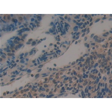 Galectin 6 (GAL6) Mouse Polyclonal Antibody