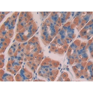 Chromodomain Helicase DNA Binding Protein 3 (CHD3) Mouse Polyclonal Antibody