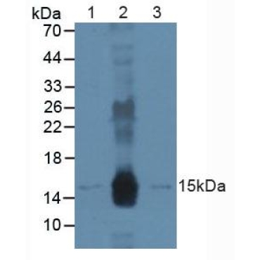 Damage Specific DNA Binding Protein 2 (DDB2) Human Polyclonal Antibody