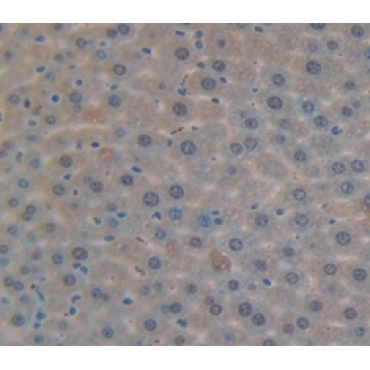 Damage Specific DNA Binding Protein 2 (DDB2) Mouse Polyclonal Antibody