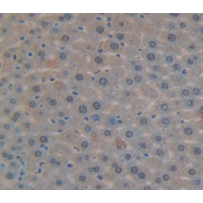 Damage Specific DNA Binding Protein 2 (DDB2) Mouse Polyclonal Antibody