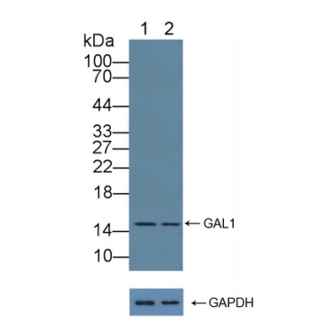 Galectin 1 (GAL1) Human Polyclonal Antibody
