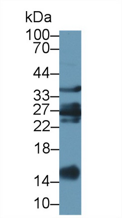 Galectin 1 (GAL1) Ovis aries; Ovine (Sheep) Polyclonal Antibody