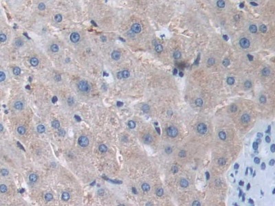 Matrix Metalloproteinase 15 (MMP15) Human Polyclonal Antibody
