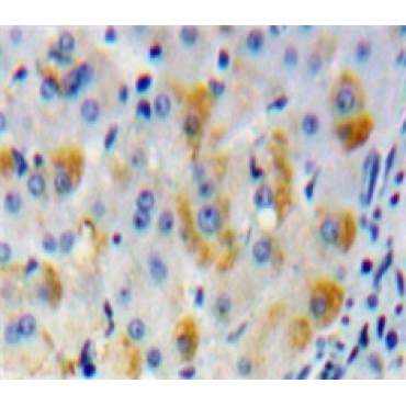 Matrix Metalloproteinase 15 (MMP15) Mouse Polyclonal Antibody