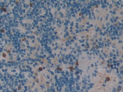 Sp100 Nuclear Antigen (Sp100) Rat Polyclonal Antibody