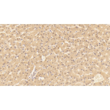 Neutrophil Cytosolic Factor 4 (NCF4) Human Polyclonal Antibody