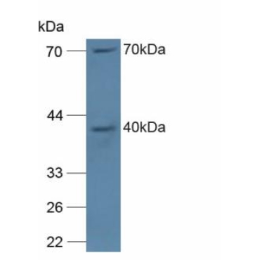 Neutrophil Cytosolic Factor 4 (NCF4) Mouse Polyclonal Antibody