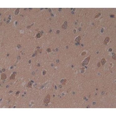 Proteasome subunit beta type-9 (PSMB9) Human Polyclonal Antibody