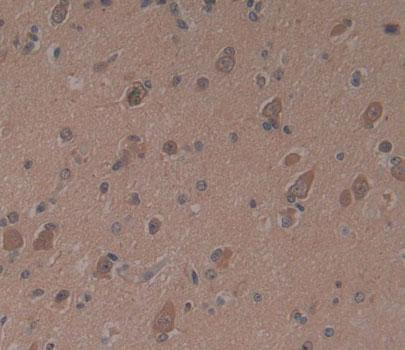Proteasome subunit beta type-9 (PSMB9) Human Polyclonal Antibody